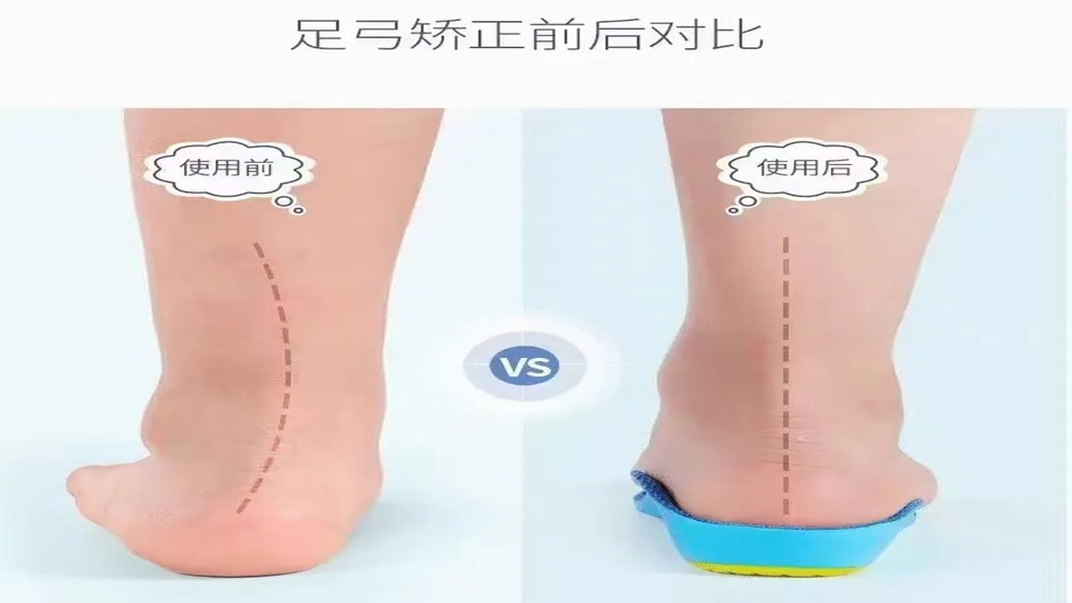 2025通用环球太原市第七人民医院脊柱健康夏令营集训活动来袭！不良体态及脊